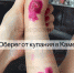 Купание в Каме обернулось кожным заболеванием для девочки из Татарстана - Вечерняя Казань