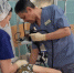Кость в горле: поевшая на ужин карасей жительница Татарстана попала на операционный стол - ТРК Татарстан-Новый век