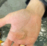 Молодой маме из Казани, пришлось вызывать МЧС, чтобы снять кольцо с пальца - ИА Татар-информ